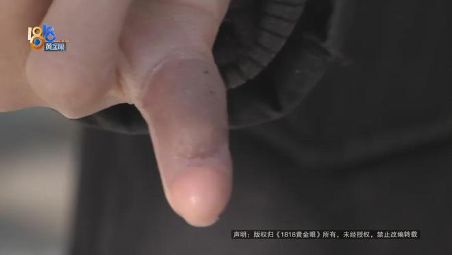 厥筋都断了……街头常见看见立即远离！凯发K8旗舰厅后怕！5岁男童瞬间晕