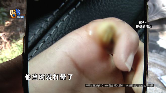 厥筋都断了……街头常见看见立即远离！凯发K8旗舰厅后怕！5岁男童瞬间晕(图8)