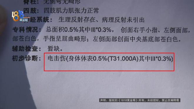 厥筋都断了……街头常见看见立即远离！凯发K8旗舰厅后怕！5岁男童瞬间晕(图5)