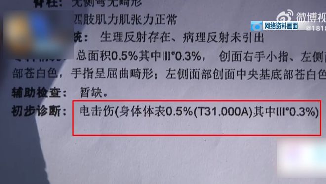 ！5岁儿童爬空调外机瞬间晕厥！凯发k8娱乐登录肌腱都打断了(图4)